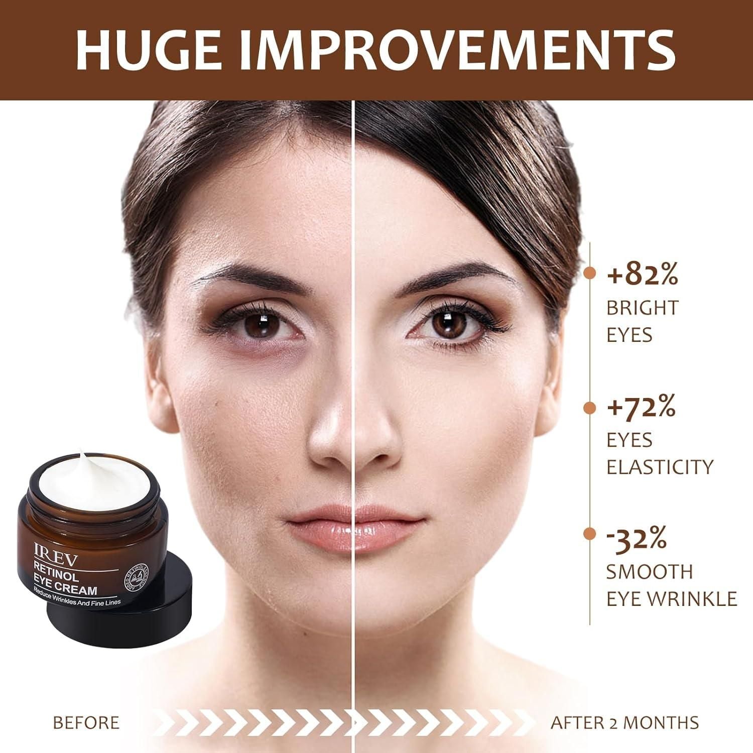 Retinol Eye Cream – Anti-Wrinkle, Dark Circle & Puffiness Treatment – Visible Results in 14 Days